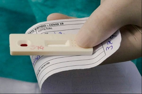 Casos ativos de Covid-19 voltam a subir em Contagem