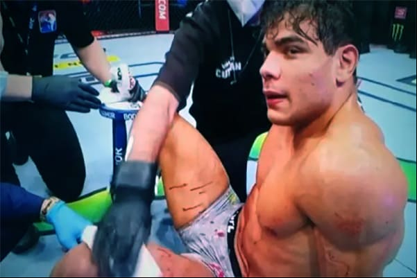 Borrachinha, lutador de MMA, acusado de agredir enfermeira durante suposta vacinação